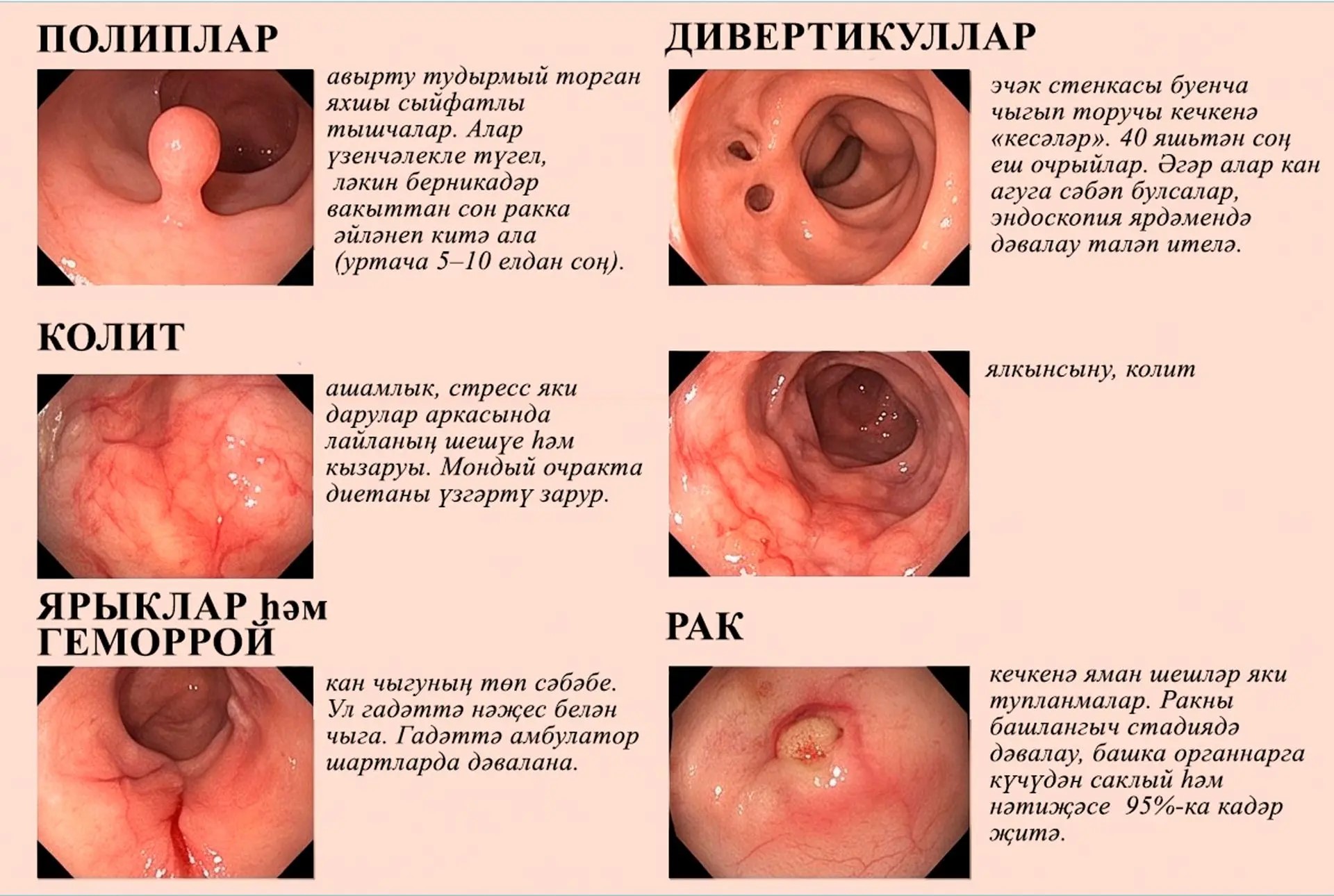 Өстәмә тикшеренү уткәндә табылырга мөмкин булган авырулар